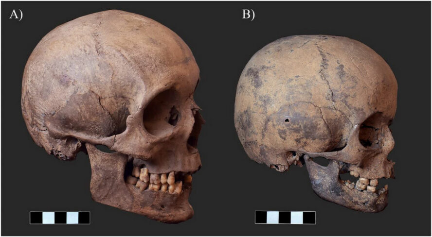 Lobanje Janoša Korvina i njegovog šestogodišnjeg sina Kristofora (Krsta) Korvina iz naučnog rada "The genetic legacy of the Hunyadi descendants - ScienceDirect"